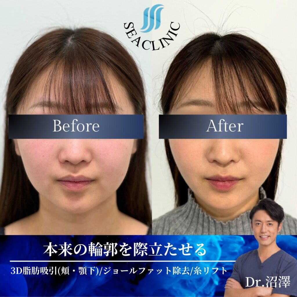 本来の輪郭を際立たせる