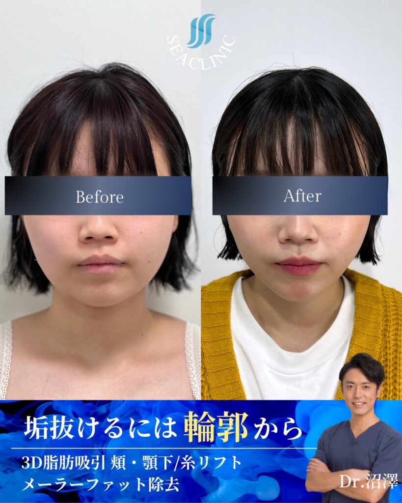 どんな丸顔の方も、シャープさを際立たせる。