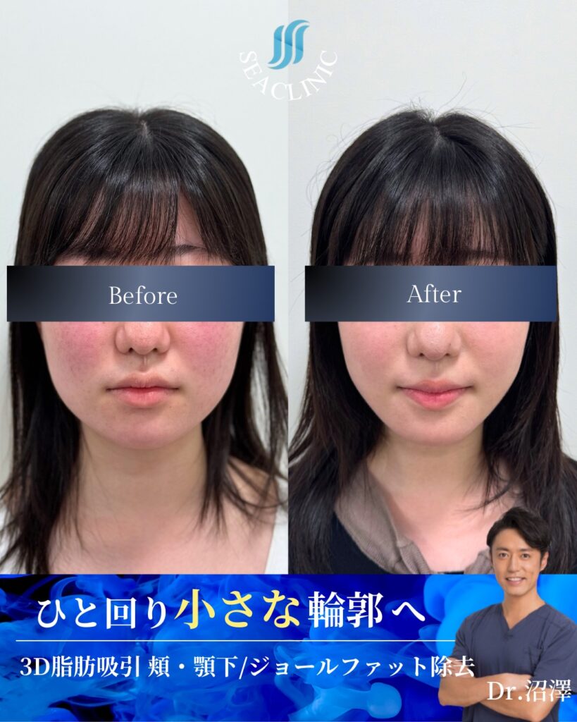 ナチュラルな変化こそ、1番の垢抜け。