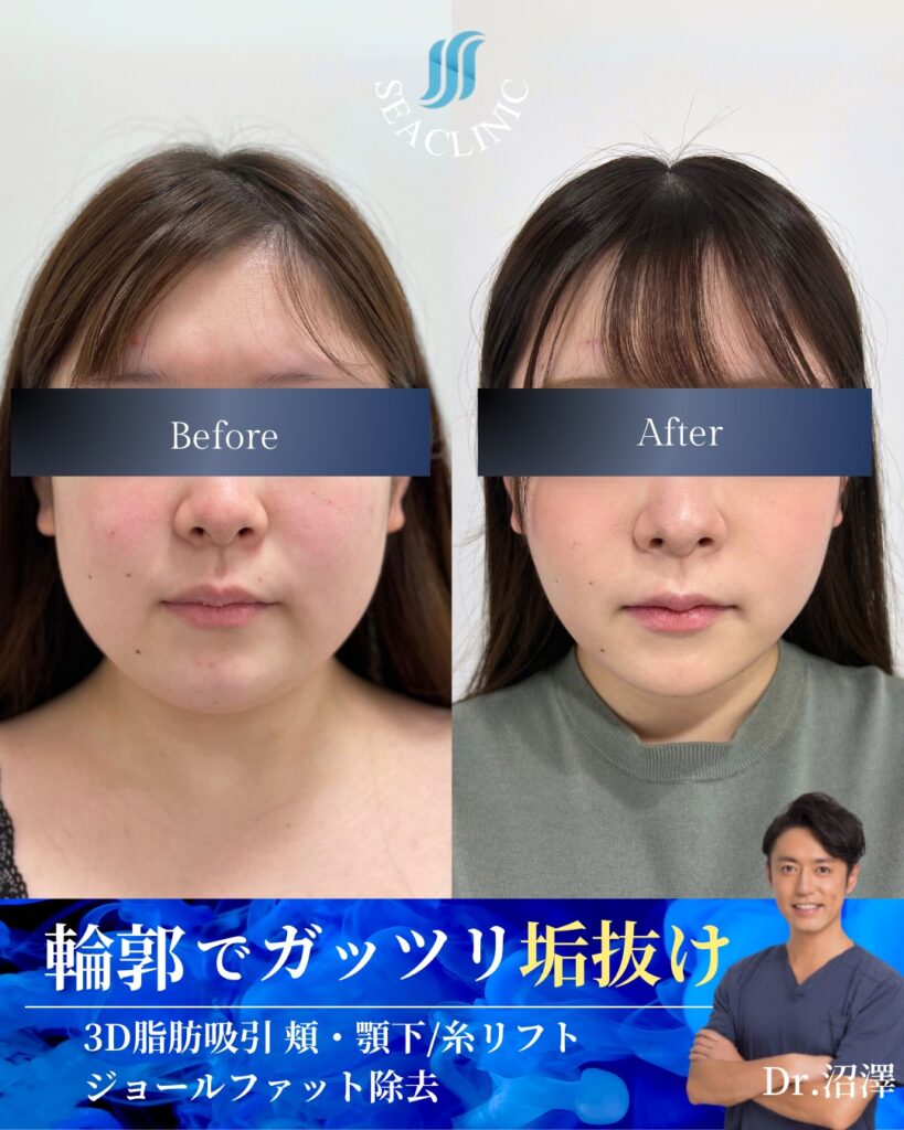 変化量を求める方必見