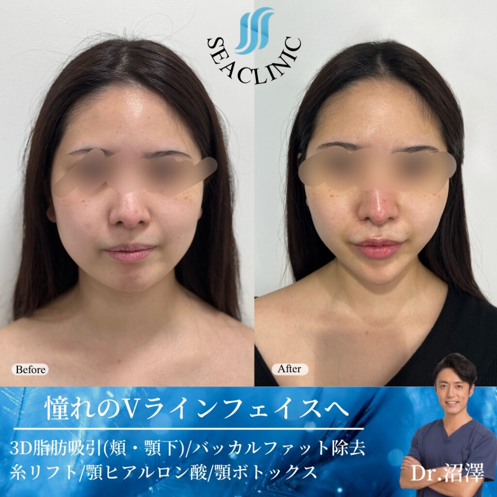 劇的ビフォーアフター公開