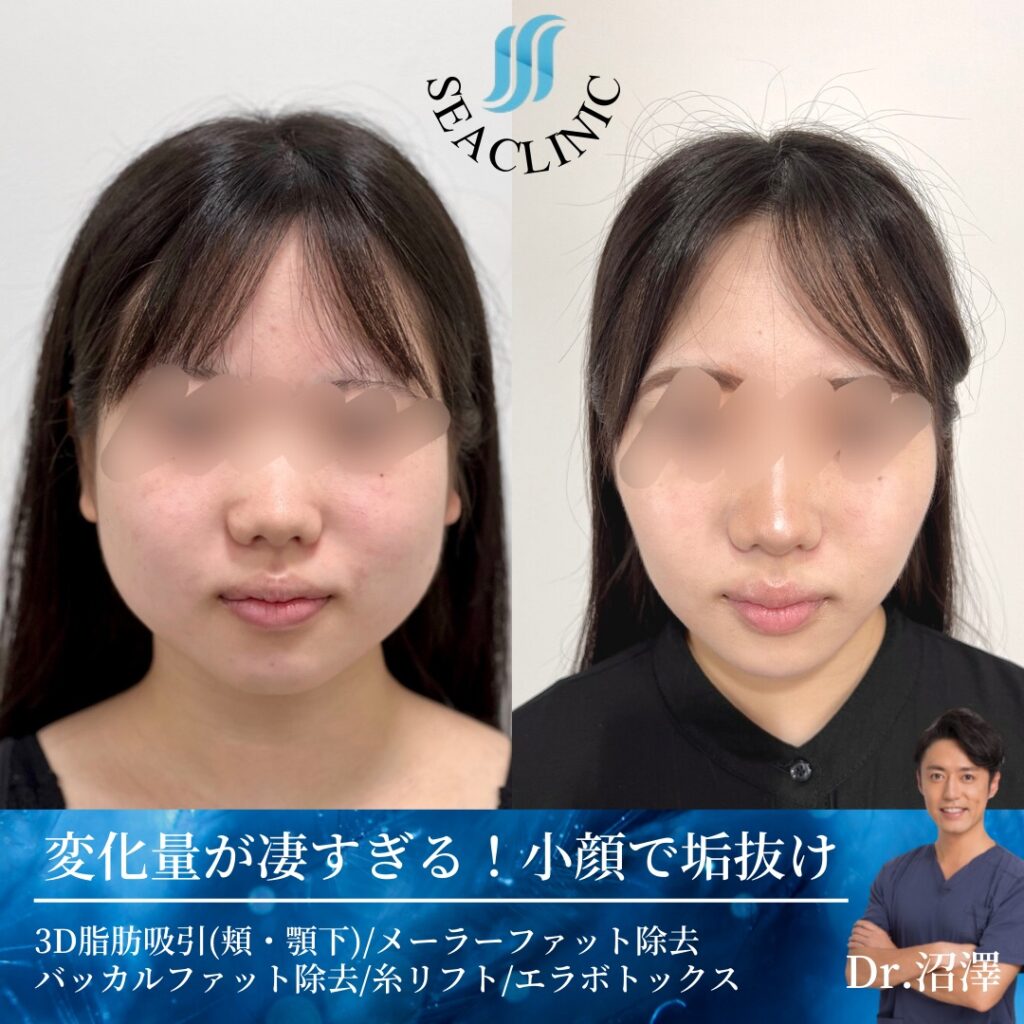 別人級の大変身！
