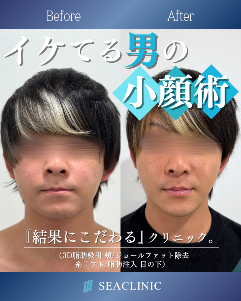 イケてる男の小顔術
