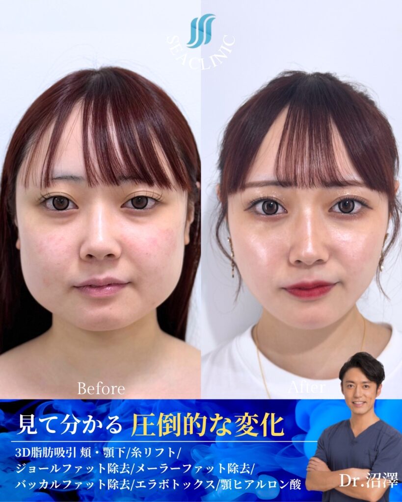 人生が変わる小顔体験。