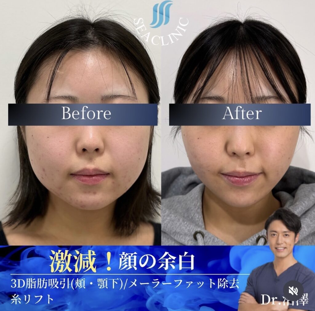 激減！顔の余白。