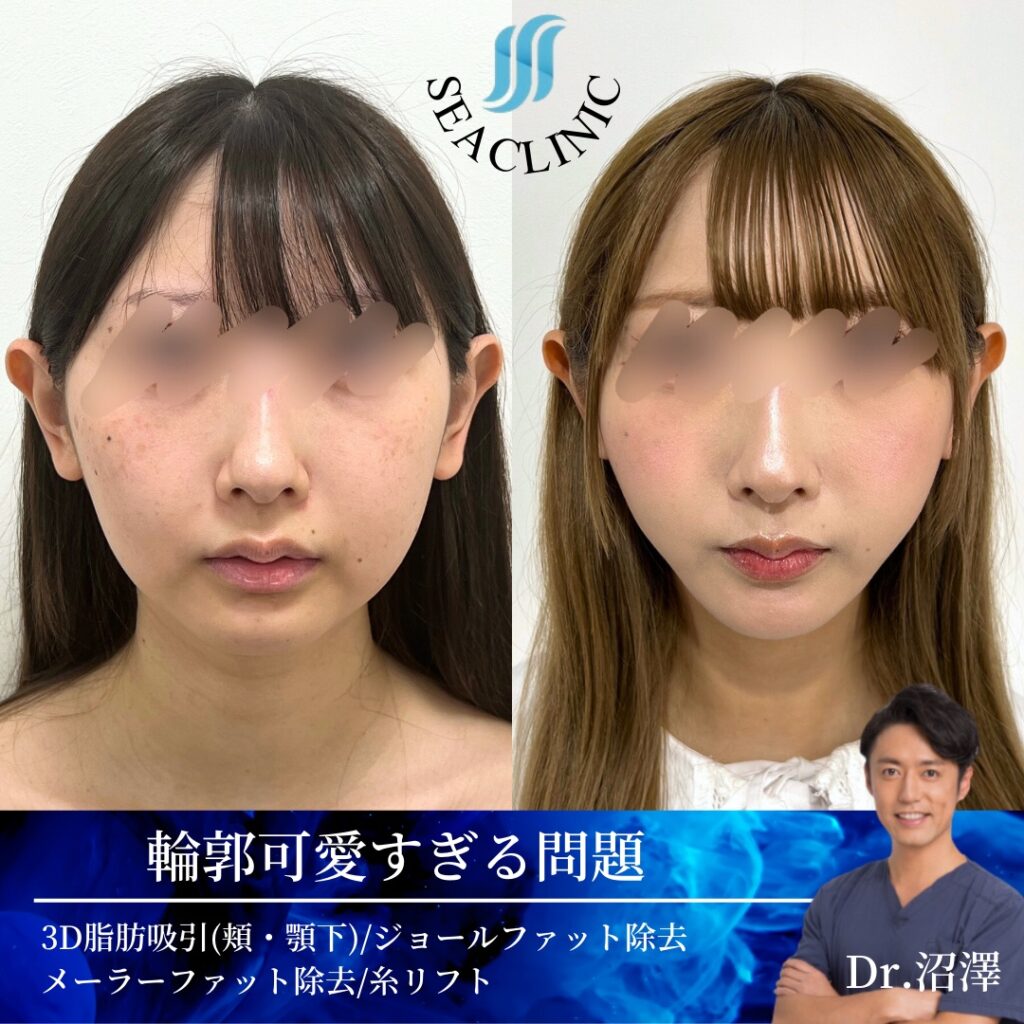 輪郭可愛すぎる問題
