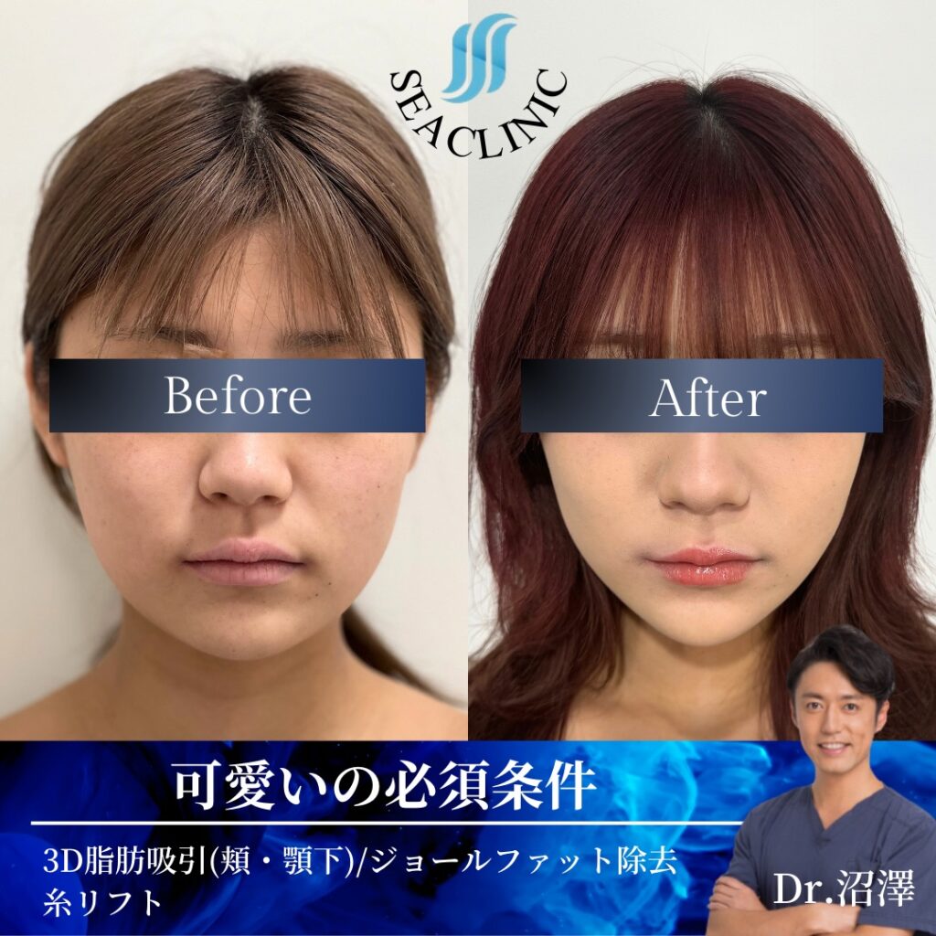 可愛いの必須条件