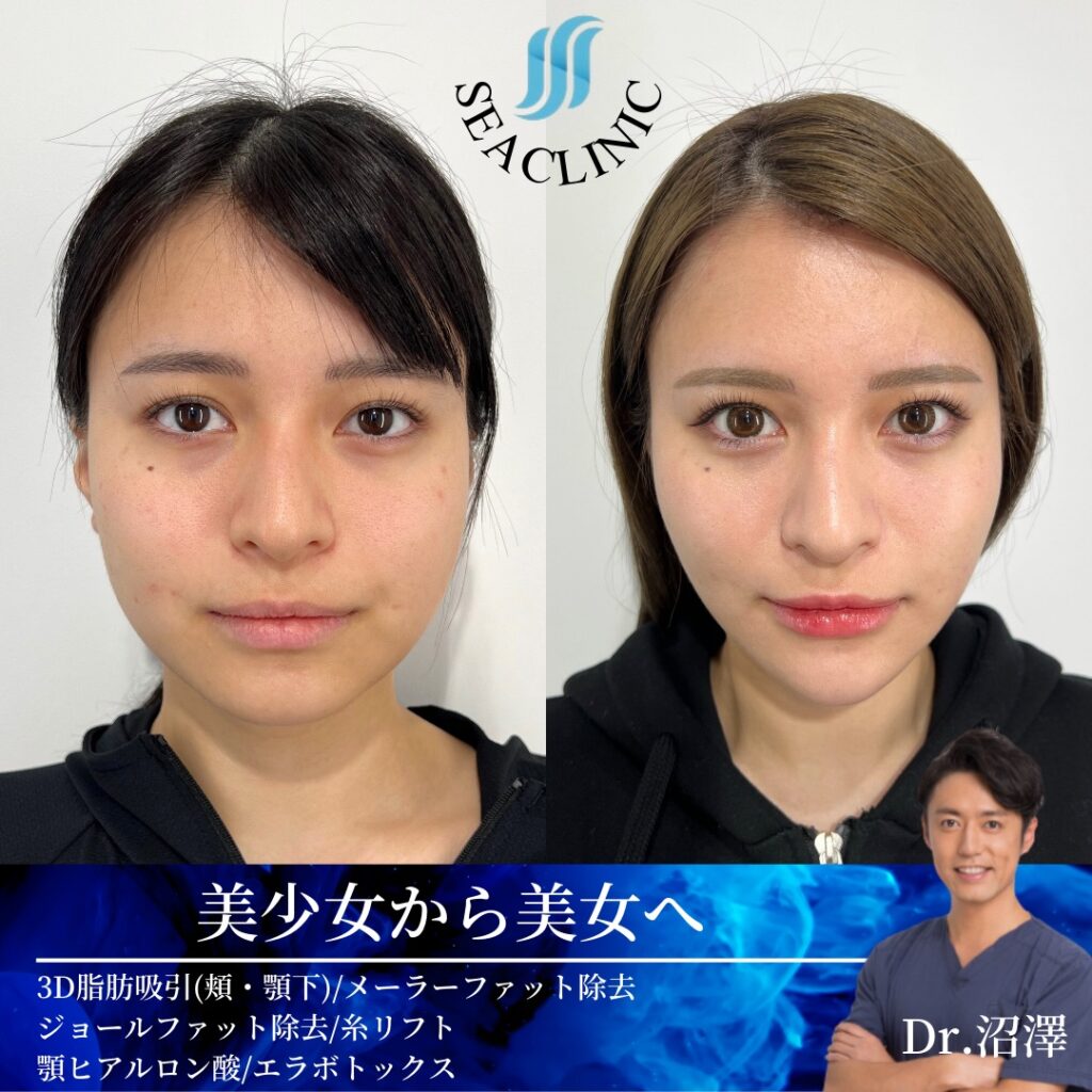 美少女から美女へ。