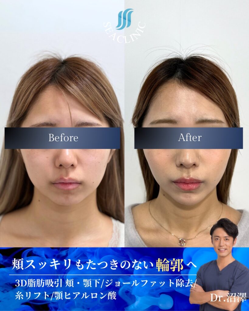 輪郭は『削る』より『整える』