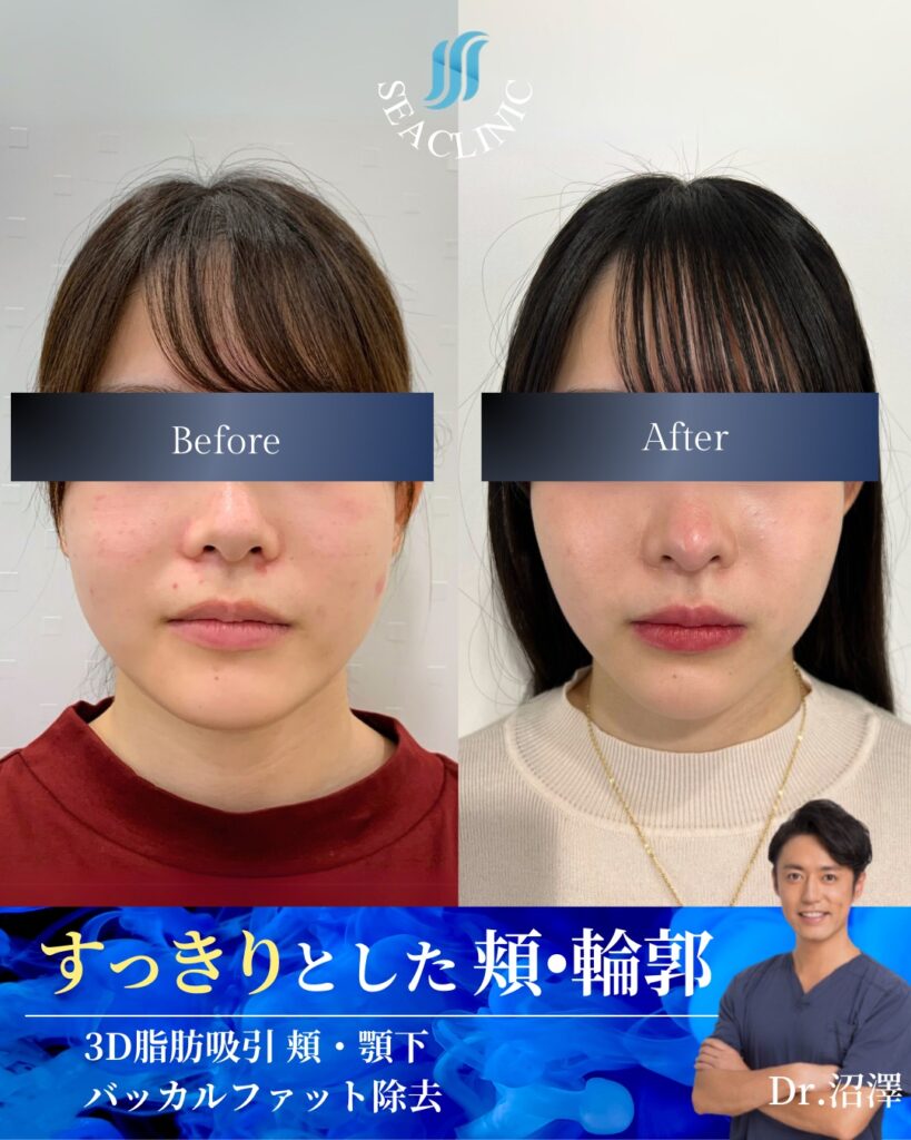 輪郭がボヤける理由はあります