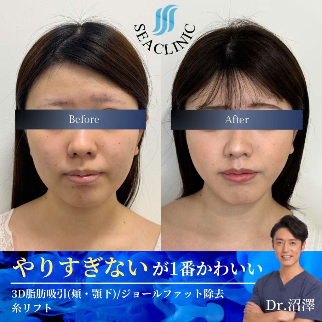 ”やりすぎない”が1番かわいい