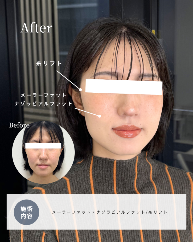 画像に alt 属性が指定されていません。ファイル名: 109-1-819x1024.png